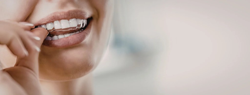 Tooth Gems Gold Coast: Safe Sparkle for Your&nbsp;Smile